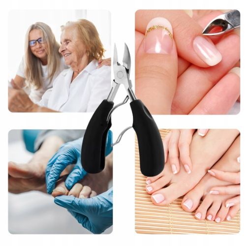 Klijesta za urasle nokte i zanoktice - prikaz upotrebe u pedikuri, manikuri i profesionalnoj njezi stopala